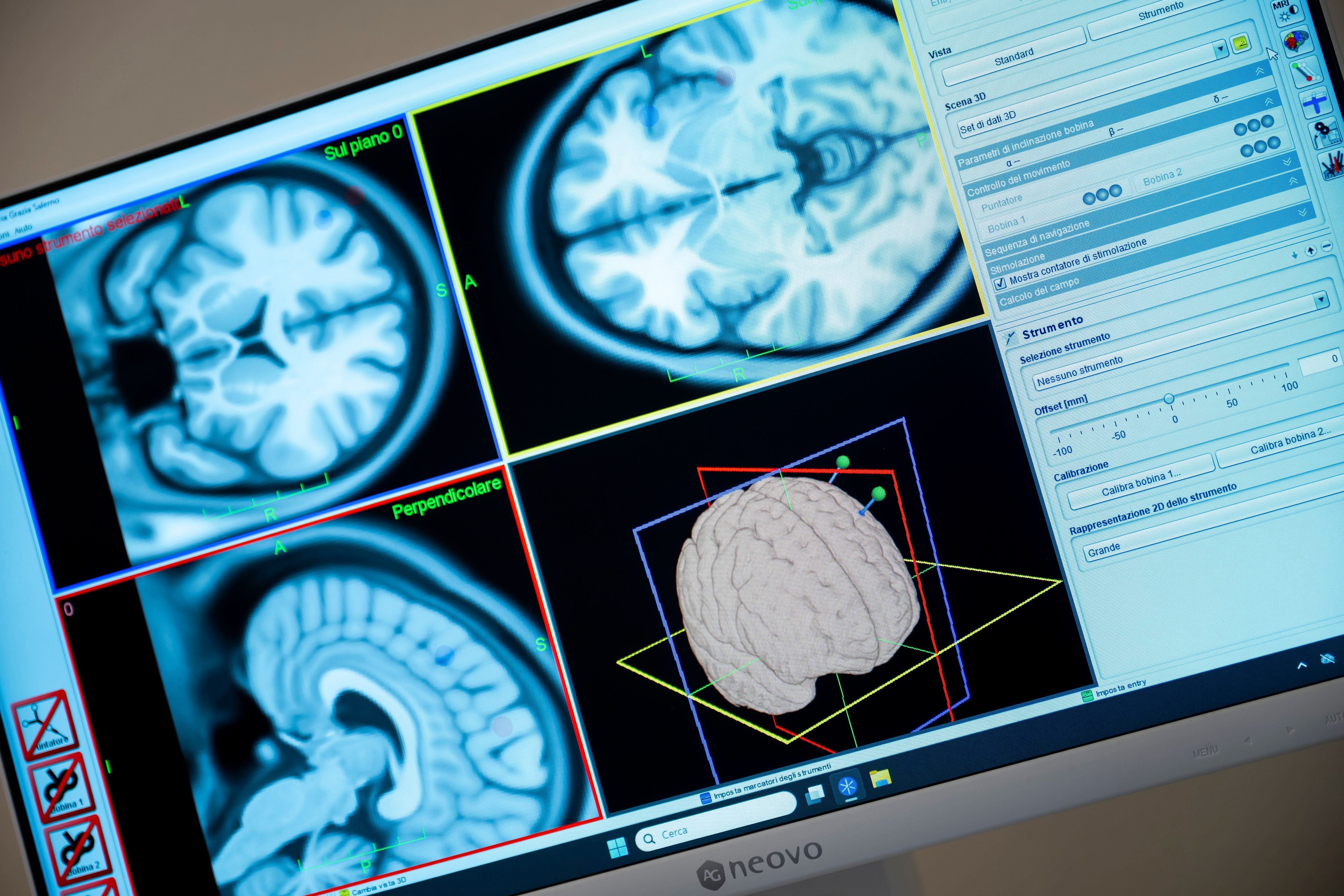 TMS validazione scientifica
